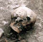 The skull of the Beauforts Beaker burial
